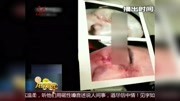 女子隆鼻注射一针下去脸歪了资讯搜索最新资讯爱奇艺