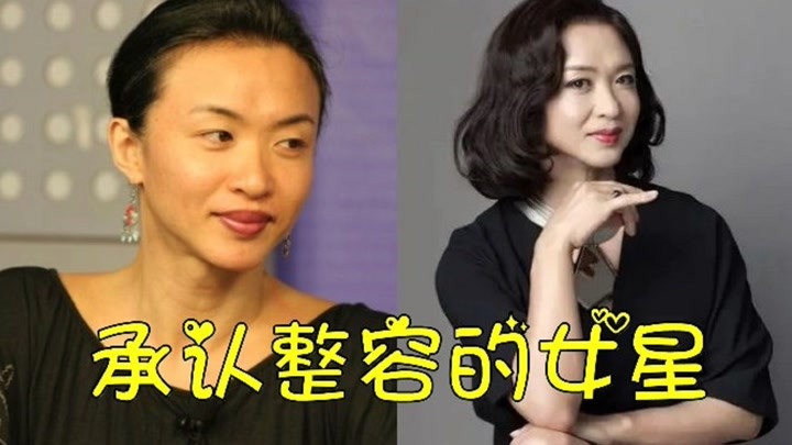 承认整容的女星,金星取出假体颜值回归,陈小纭"磨骨"判若两人