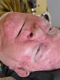 一小儿麻痹症患者靠“铁肺” 生活70年-资讯-搜索最新资讯-爱奇艺