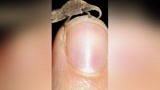 岛屿侏儒症 全球最小蜥蜴