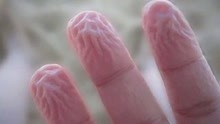 手指泡水之后坑坑洼洼